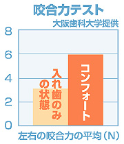 コンフォートデンチャー