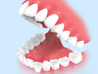 矯正歯科治療はなぜ必要か？