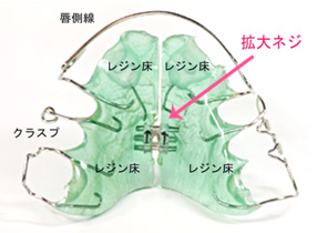 拡大床