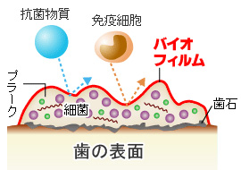 バイオフィルム