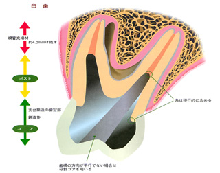 臼歯