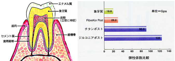 歯と土台の力学的関係