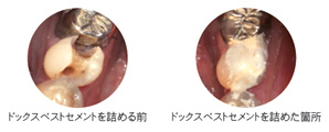ドッグスベストセメント