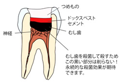 ドッグスベストセメント
