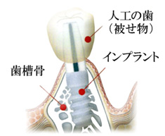 歯槽骨