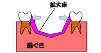 床矯正