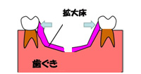床矯正