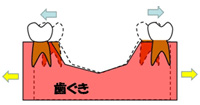 床矯正