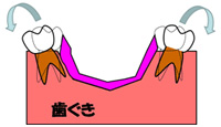 床矯正