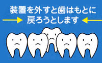 床矯正について