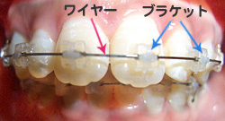 始める期間と時期